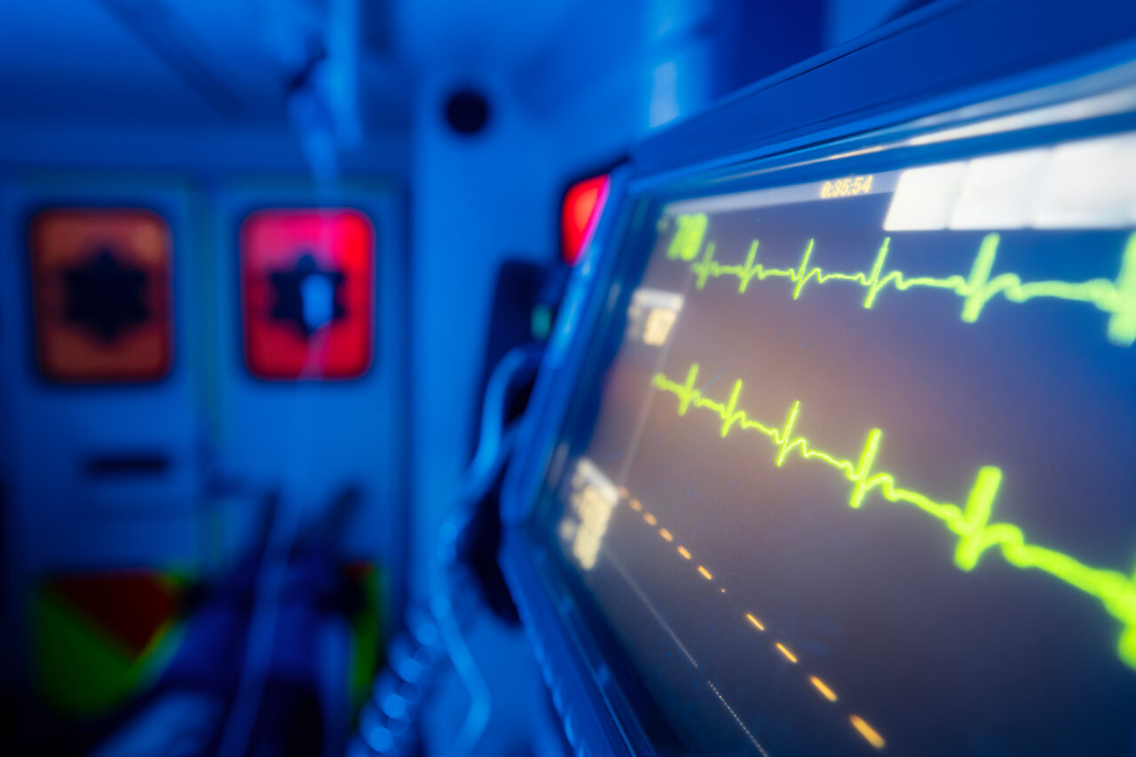 Medical monitor showing a bright green ECG waveform in a blue-toned clinical setting with blurred emergency equipment in the background (ambulance/ER) - suggesting possible Heart Attack and Pulmonary Embolism Malpractice.
